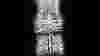 blog_bodyscan_original.jpg