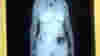 blog_woman_xrayscan_original.jpg